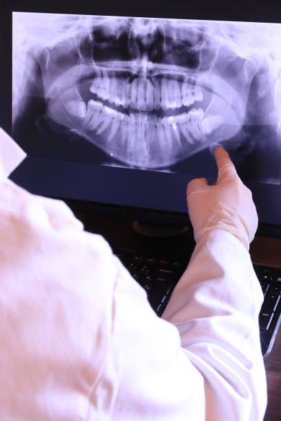 Best Emergency Dental Extractions in Grissom Af, IN
