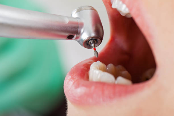 Best Orthodontic Emergency Dentist in Grissom Af, IN